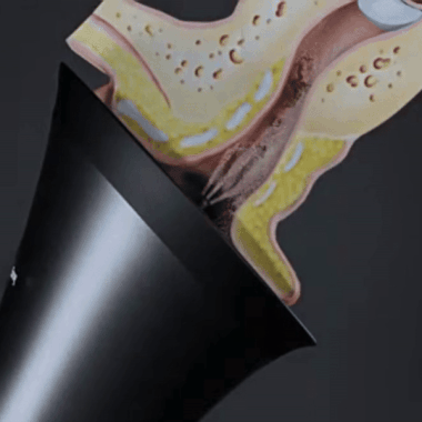 Voldic™ Elektrisk Ørevoksfjerningssett